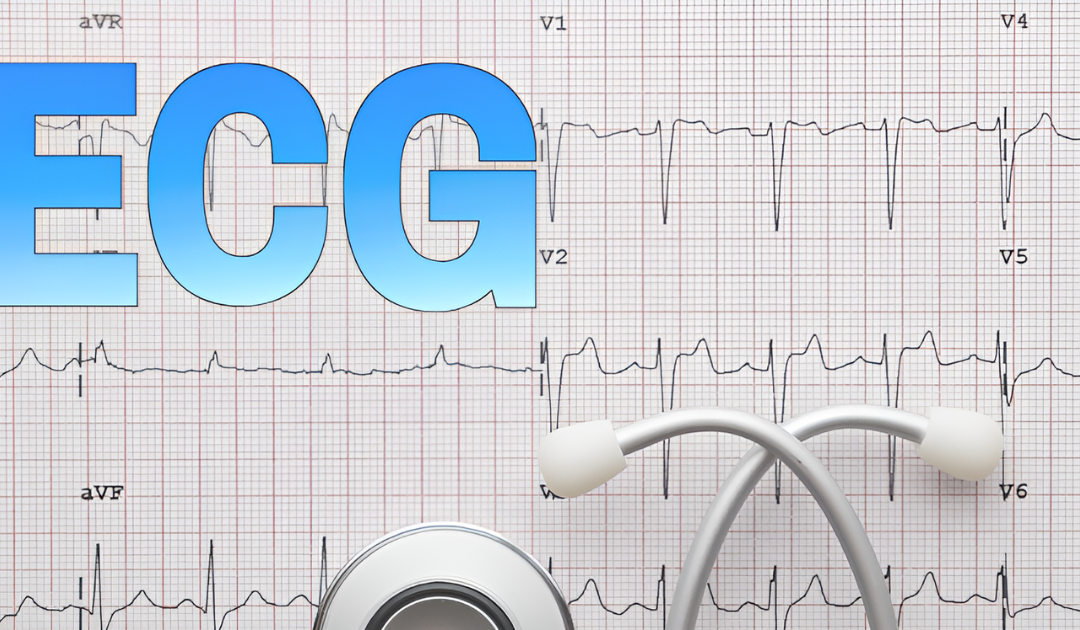 Know About ECG Test