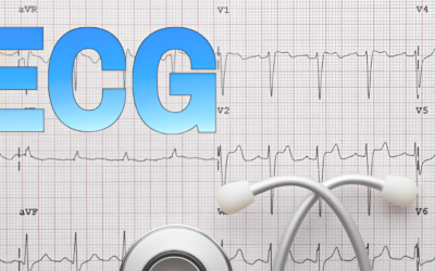 Everything About ECG Test